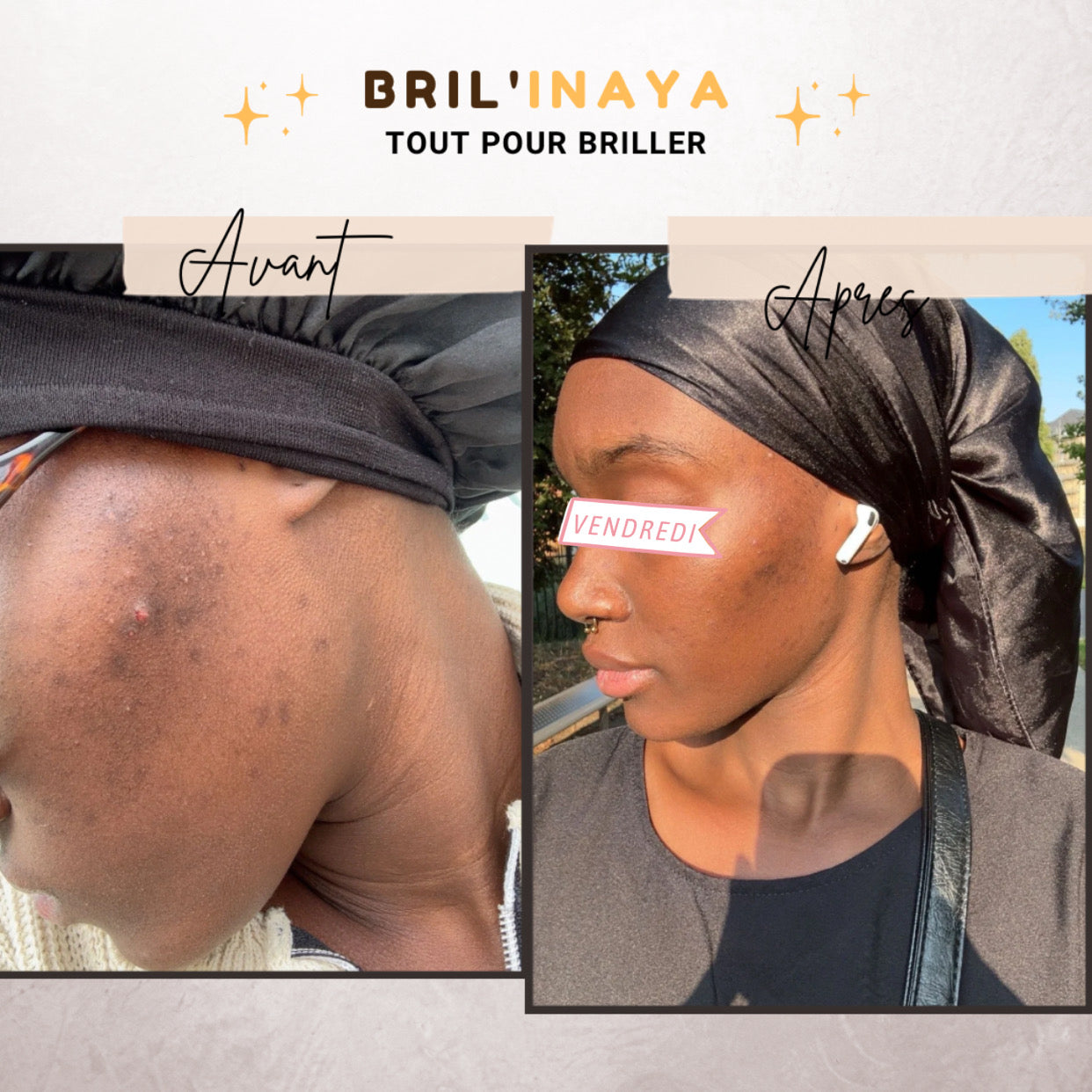 Gamme au Curcuma 🥇