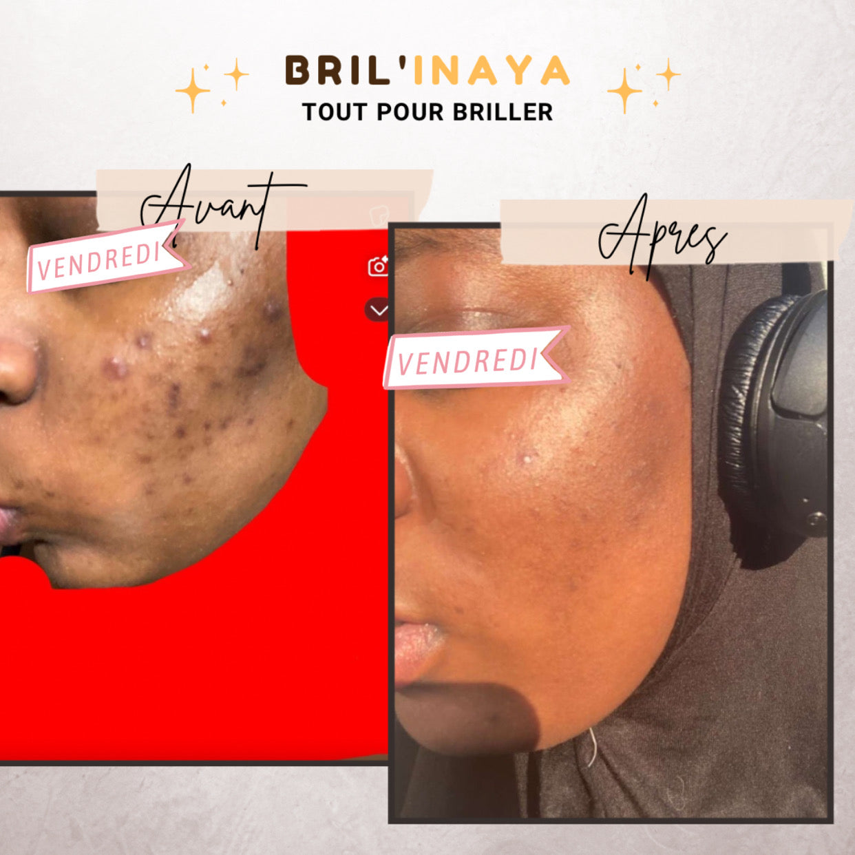 Gamme au Curcuma 🥇